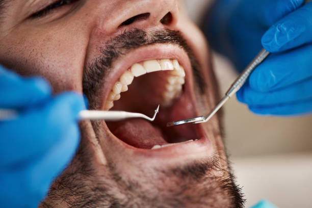 Best Dental Fillings (Composite and Amalgam)  in Martinsburg, WV
